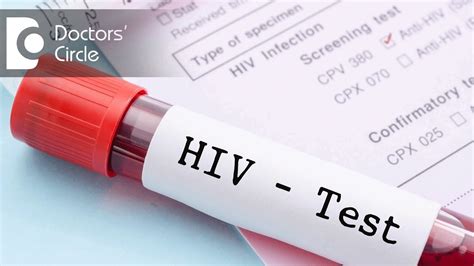 elisa test of hiv|how long after an exposure to hiv should someone test.